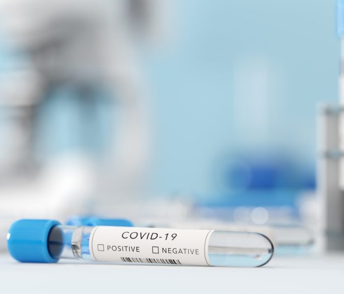 Testing for coronavirus Covid-19 in a lab. Covid medical screening